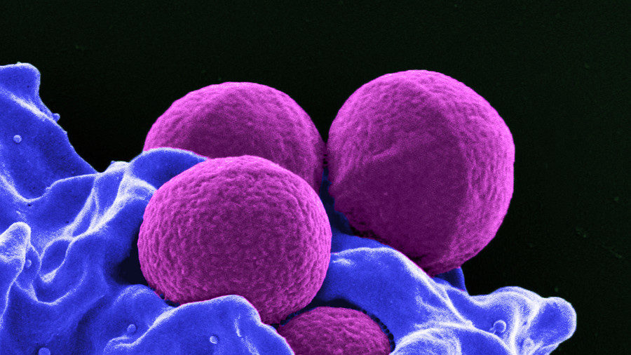 gene editing