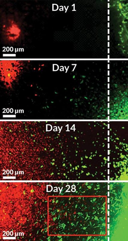 Click to enlarge CRISPR killer cancer cells