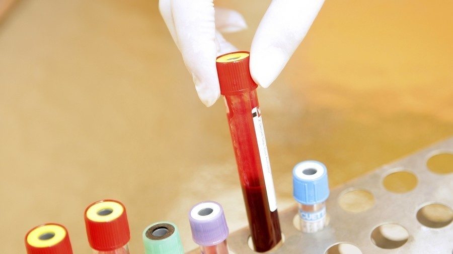 test tubes