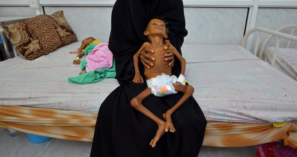 Click to enlarge six-year-old boy Yemen