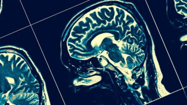 Click to enlarge brain