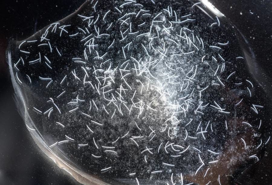 Spirostomum ambiguum fast microbes