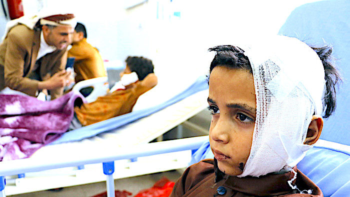 Click to enlarge Yemeni child