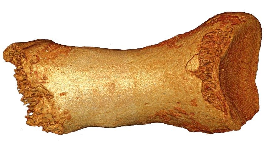 toe bone