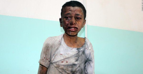 Yemeni child