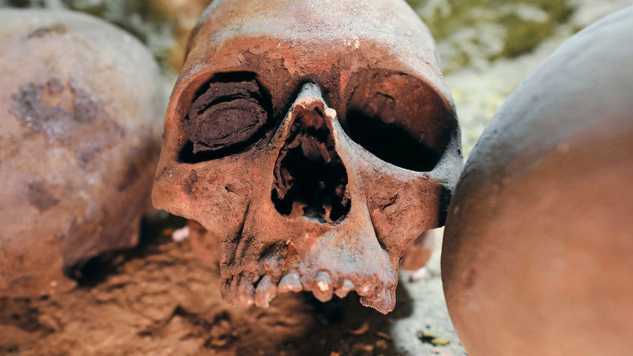 Click to enlarge Human Skull