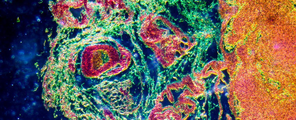 Lymph gland tissue