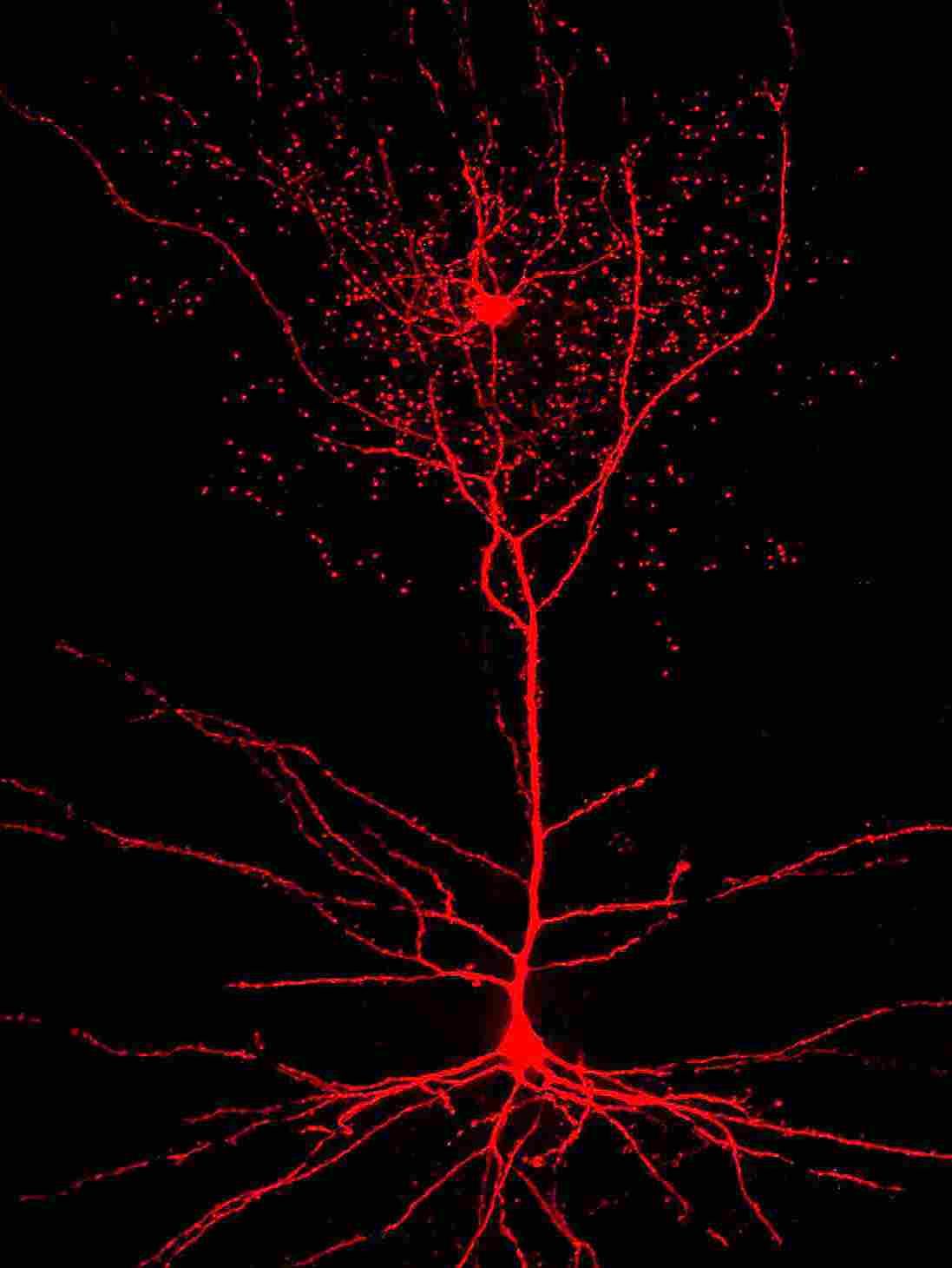 rosehip neuron pyramidal cell