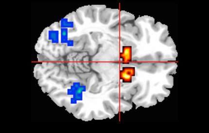 Click to enlarge cbd brain
