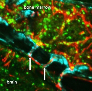 Click to enlarge skull brain immune cells tunnels