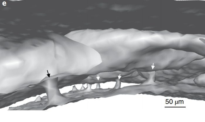 skull brain immune cells tunnels