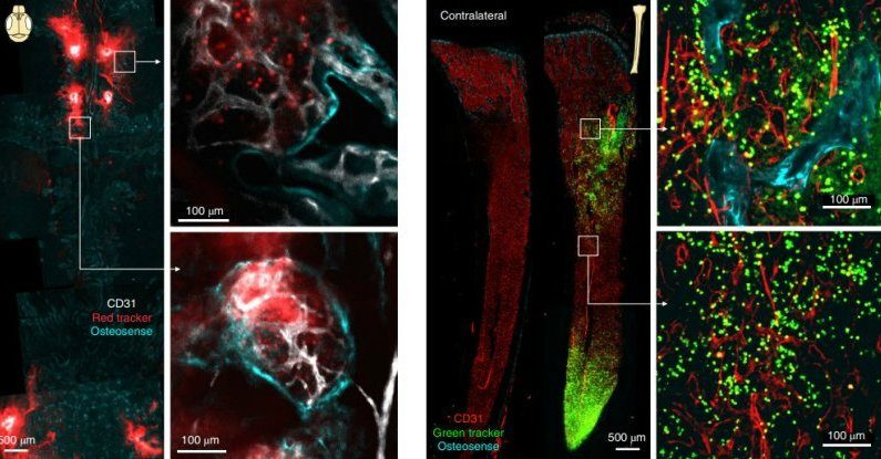 Click to enlarge skull brain immune cells tunnels
