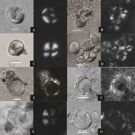 Click to enlarge Microscopic traces of ancient starches
