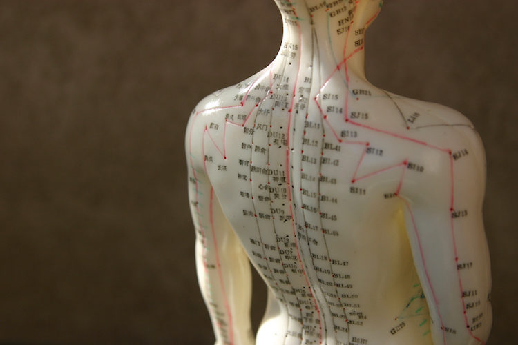 Click to enlarge acupuncture