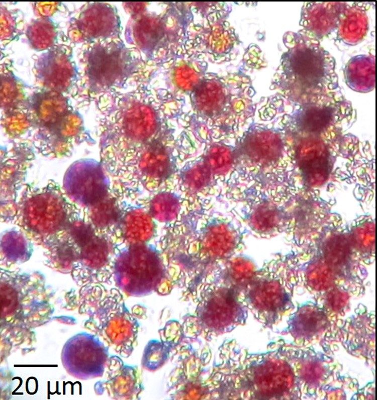 Click to enlarge microscopic algae