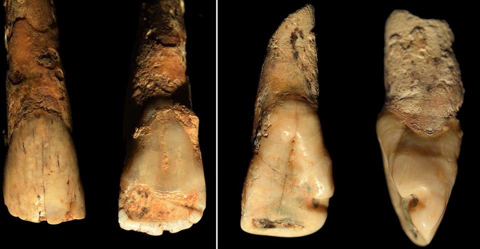 bronze age teeth