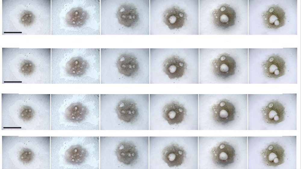 Human Egg Cells