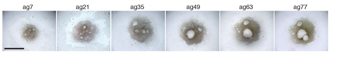 Click to enlarge HUman Egg Cells