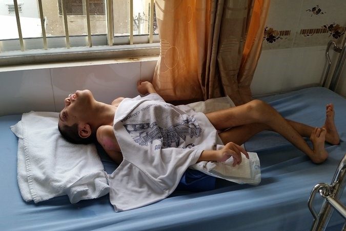 agent orange vietnam