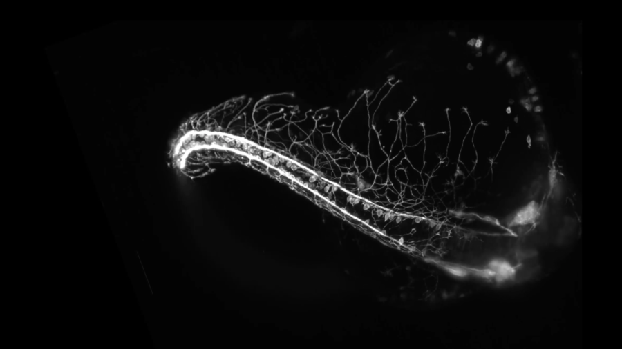 nervous system