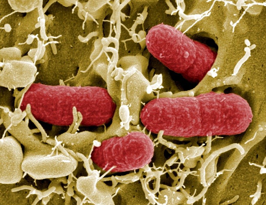 Bacteria