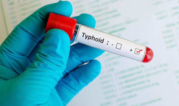typhus