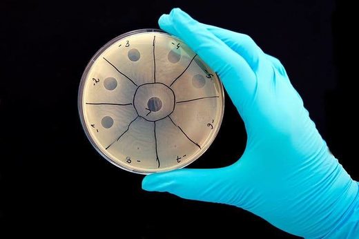 bactria culture petri dish