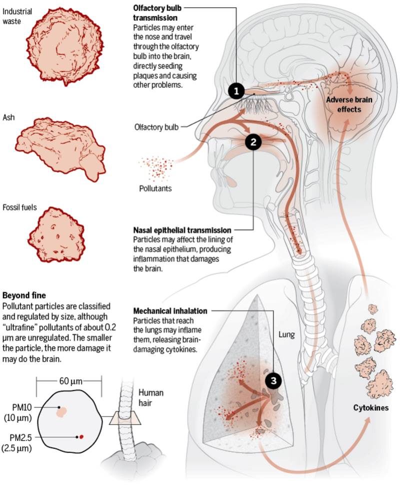 air pollution brain inflammation alzheimers