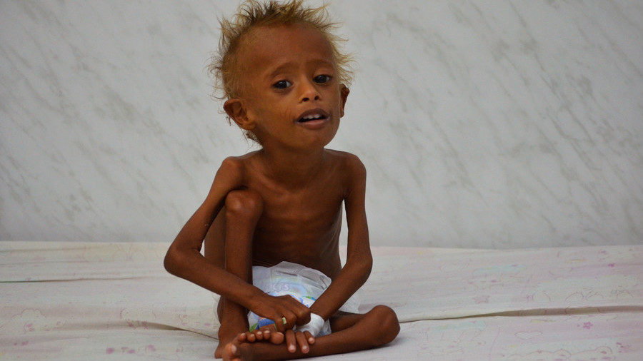 Saudi created famine Yemen