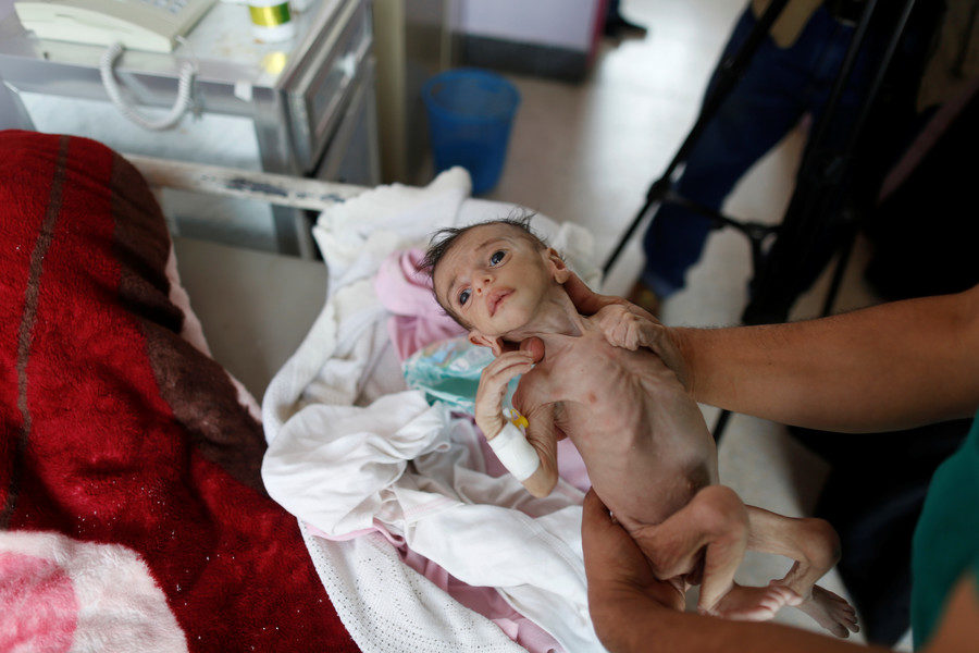 Saudi created famine Yemen