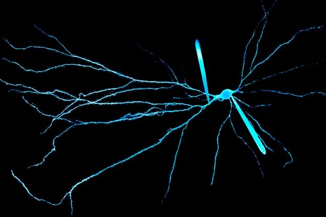 Click to enlarge dendrites