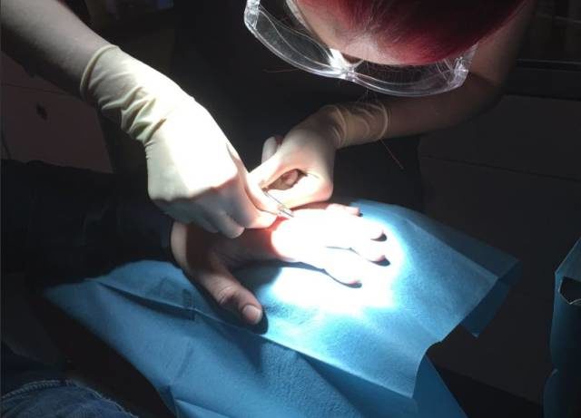 Biohackers implanting everything