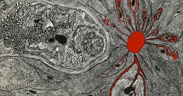 Click to enlarge infected minds