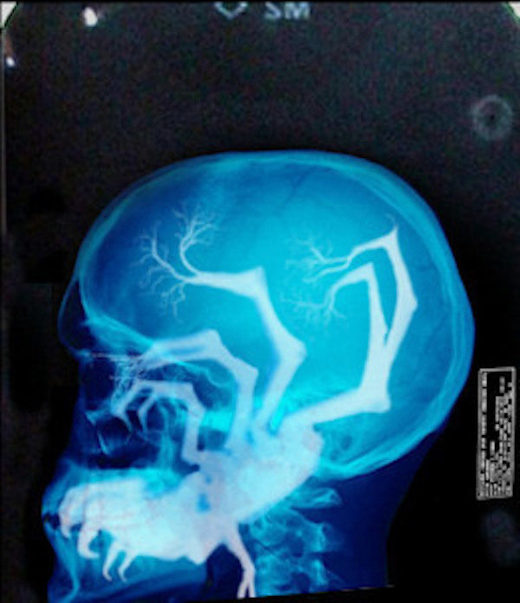 Click to enlarge x-ray parasite