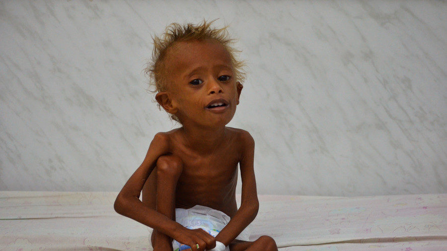 Click to enlarge yemen child