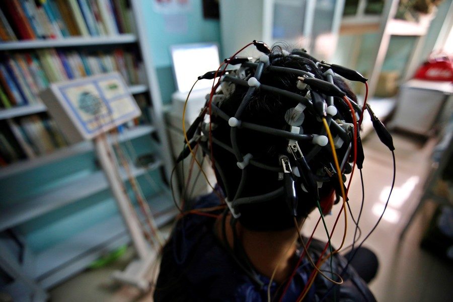 Click to enlarge brain study