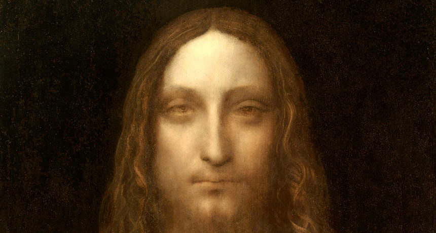 da vinci exotropia