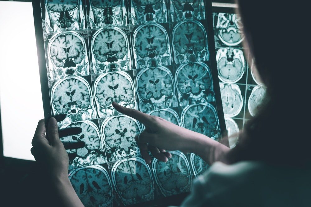 Click to enlarge MRI of Brain
