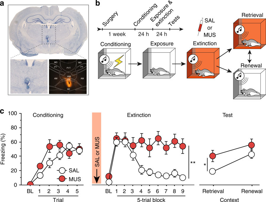 Click to enlarge Workings of the brain