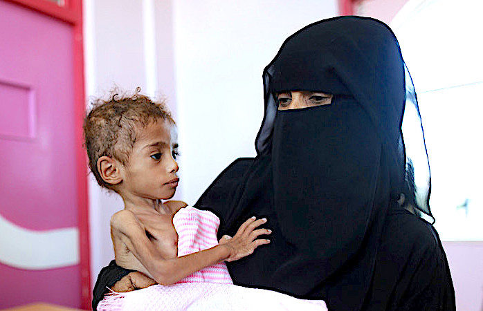 Starving child
