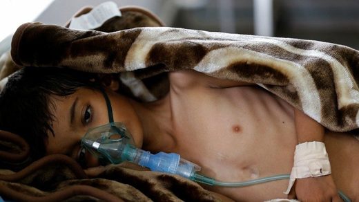 Click to enlarge Starvation Yemen