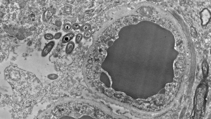 bacteria