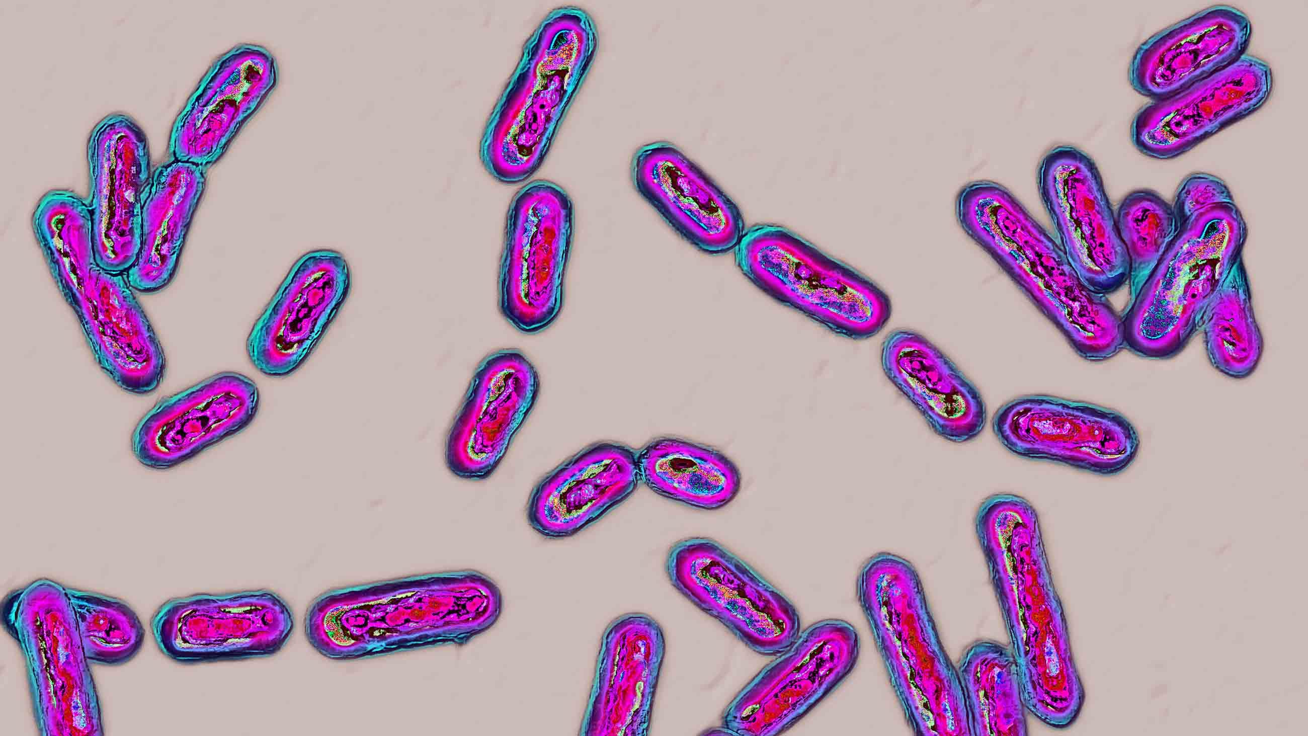 Click to enlarge Clostridium difficile