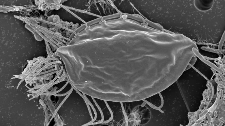 Click to enlarge Hemimastigotes