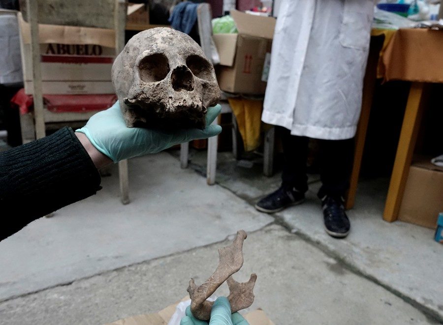 Skull and bones