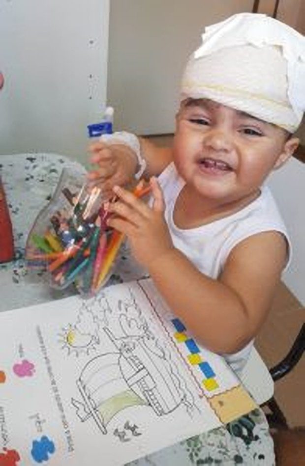 INJURED: Little Julia Balardim was rushed into emergency surgery after a monkey attacked her