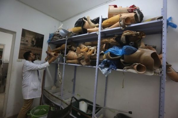 Click to enlarge Prostheses stack