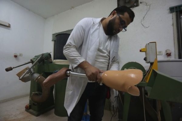 Click to enlarge A technician prepares a limb