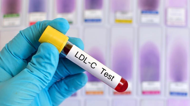 LDL cholesterol test