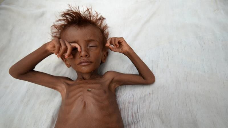 Yemen child